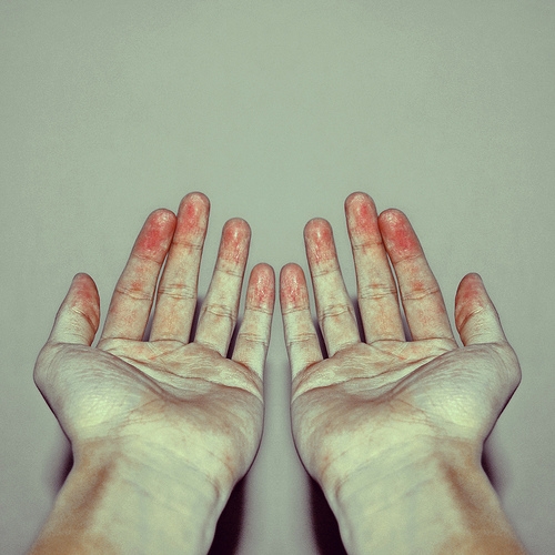 blood on hands